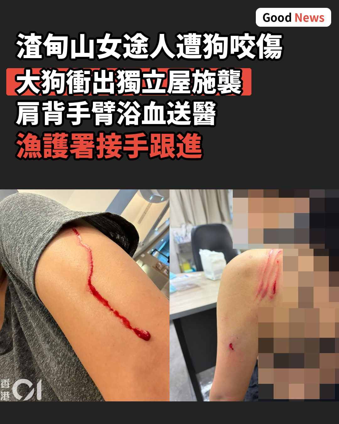 渣甸山女途人遭大狗撲襲咬傷肩背 漁護署跟進